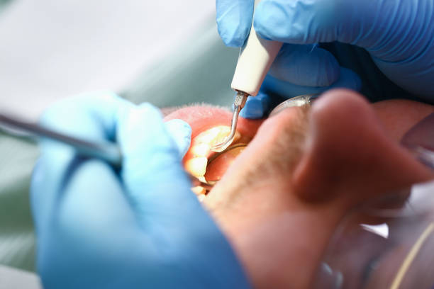 Best Emergency Treatment for Toothache in Rushvle, IL