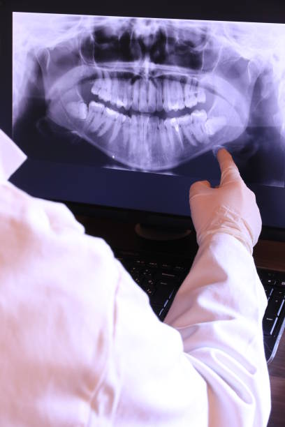 Best Emergency Dental Surgery in Rushvle, IL