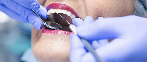 Best Emergency Root Canal Treatment in Rushvle, IL